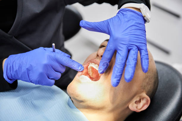 Best Urgent Care for Lost Fillings or Crowns in West Dennis, MA